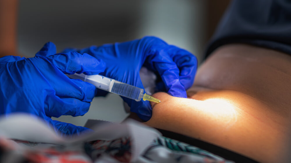 What makes FUE Hair Transplant Procedure the most Successful Technique?
