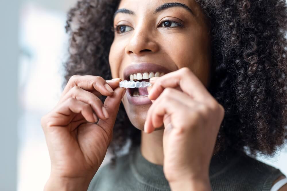 Invisalign braces Kenya
