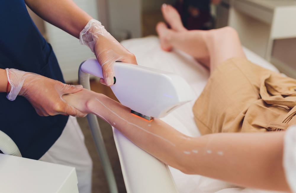 Laser hair removal cost Nairobi 