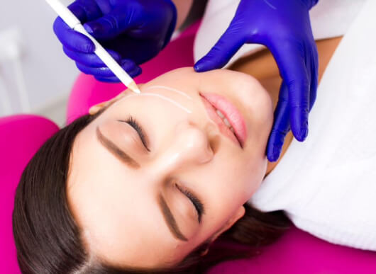 non-surgical-facelift